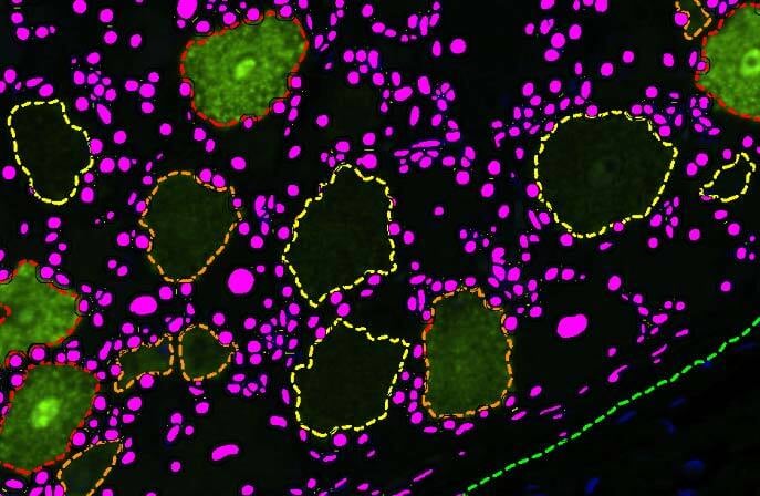 Visopharm Neurons Molecular Biology