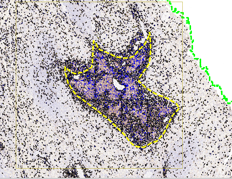 Flying Witch-002-CD3-IHC-Membrane Stain-Label-ROI - Golnaz Jalalahmadi