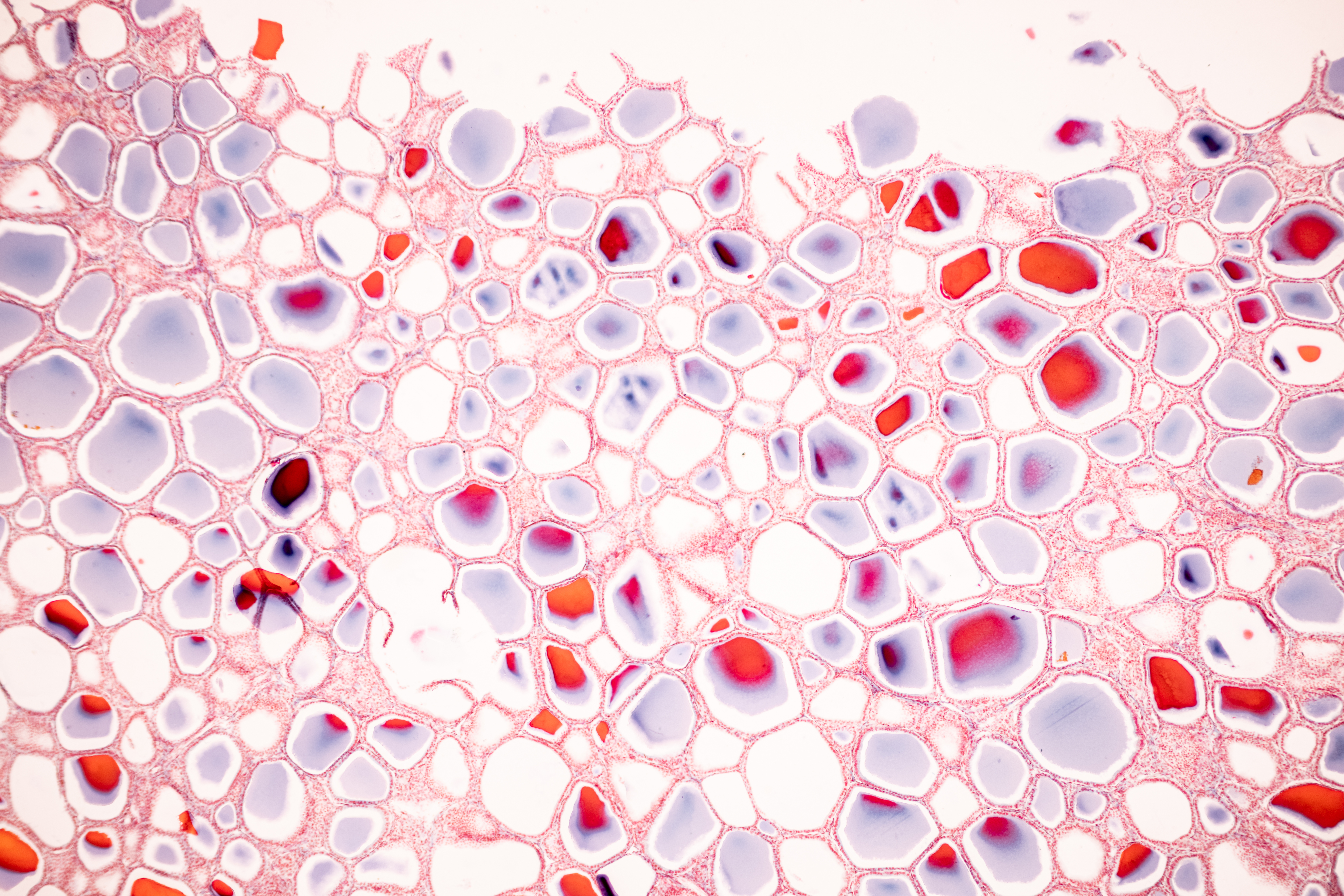 AdobeStock_620382733