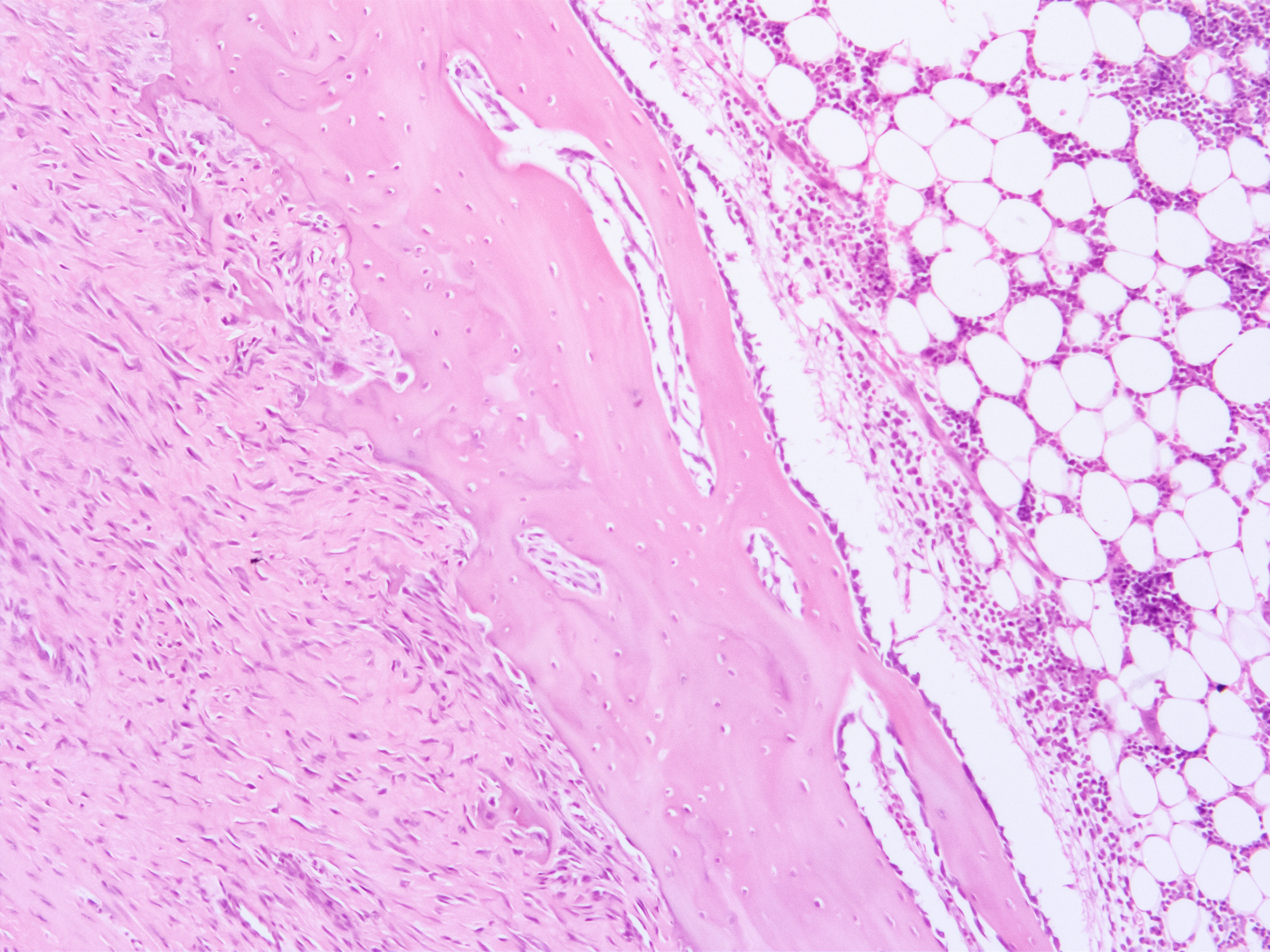 AdobeStock_649258885