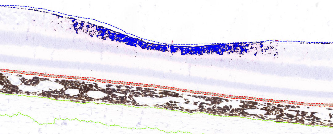 about-fovea-1