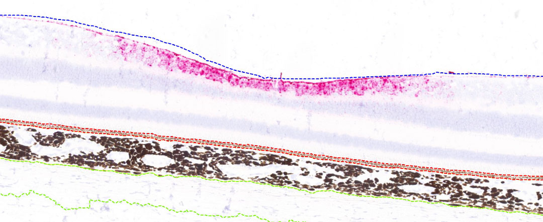 about-fovea-2