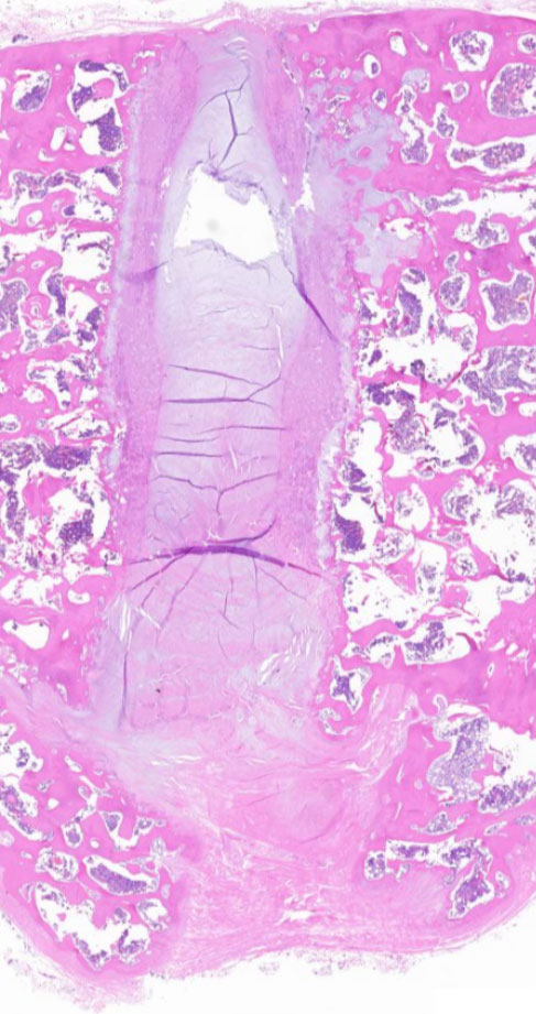 Aging Biology - Osteoporosis