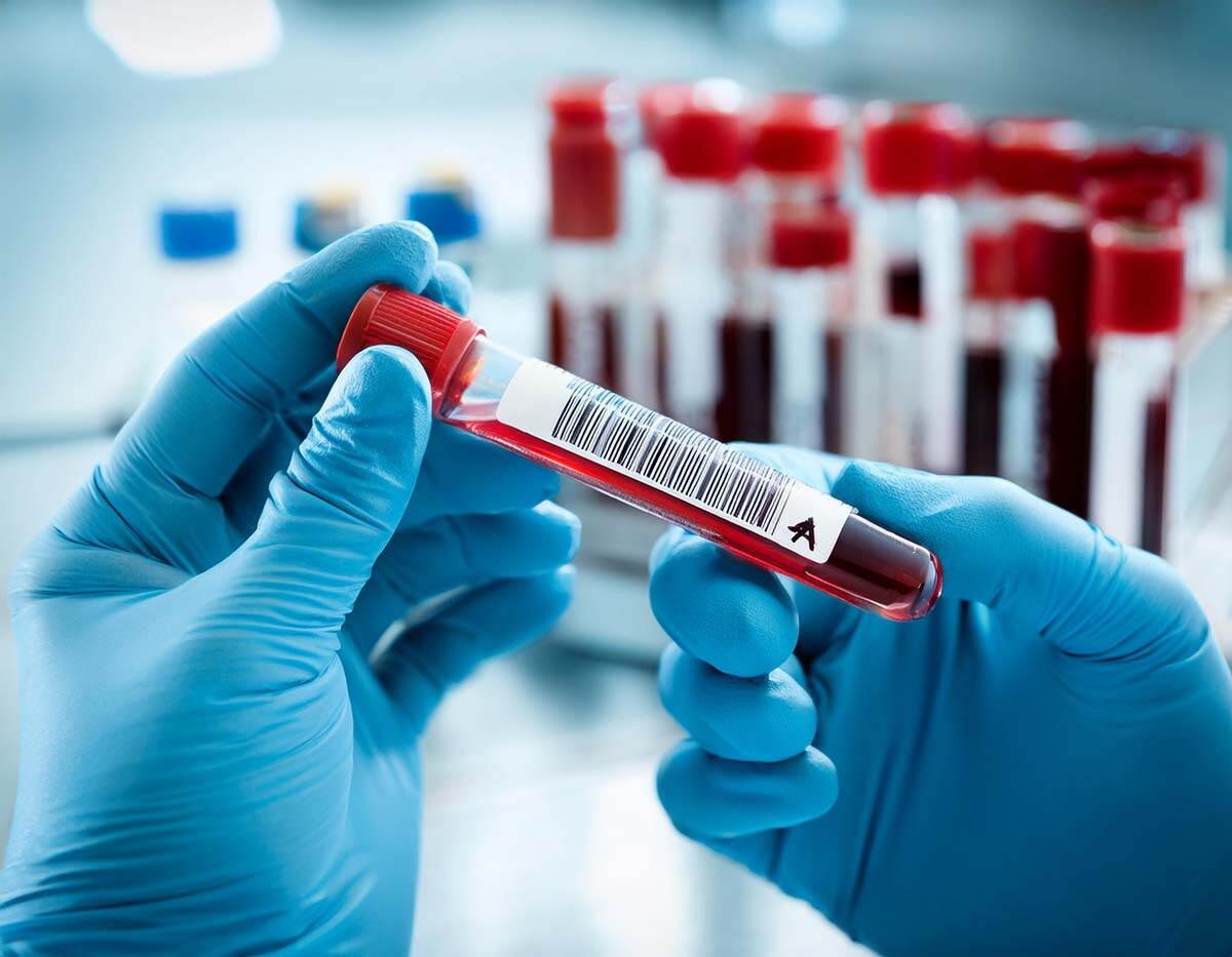 blood-sample