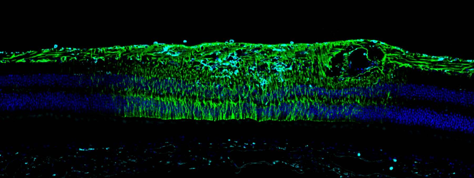 GFAP immunohistochemistry of astrocytes, demonstrating resting and reactive astrocytes, and IBA1 highlighting resting and activated microglia