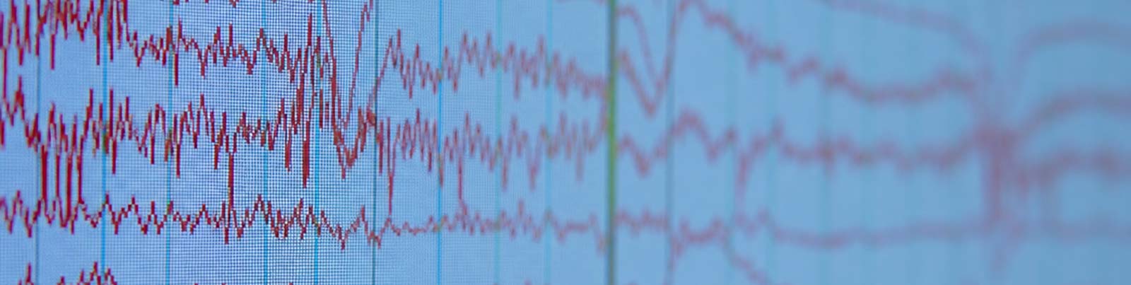 eeg-waveforms