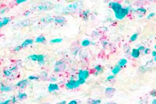 histology-duplex-ihc