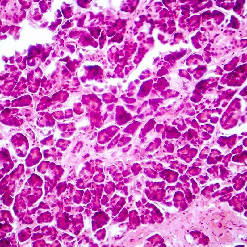 histology-slide-square