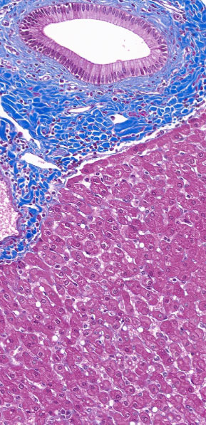 immunohistochemistry-liver-fibrosis-1