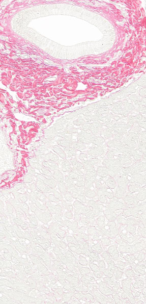immunohistochemistry-liver-fibrosis-2
