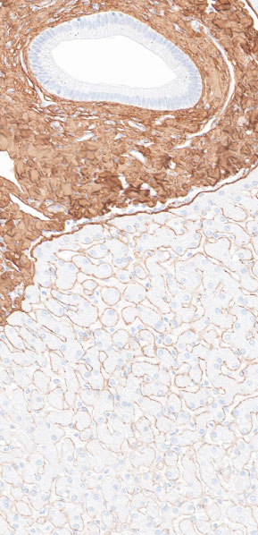 immunohistochemistry-liver-fibrosis-3