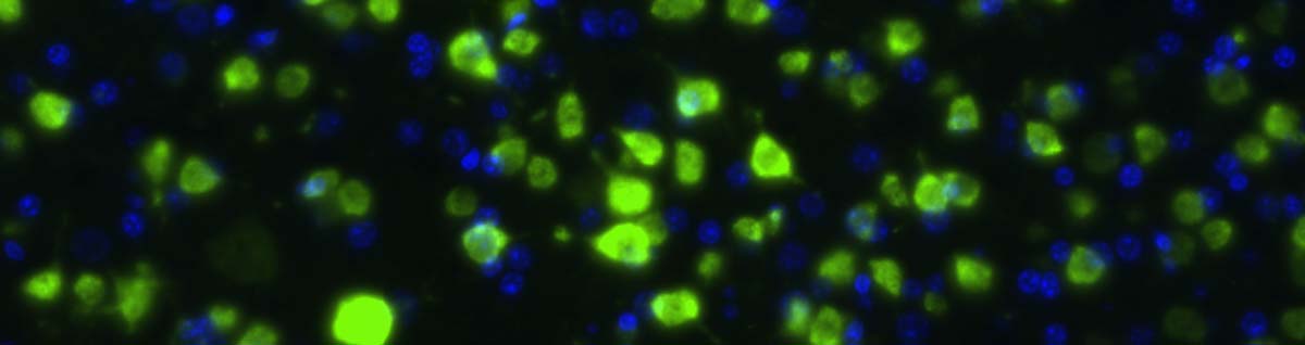 neurons-bar