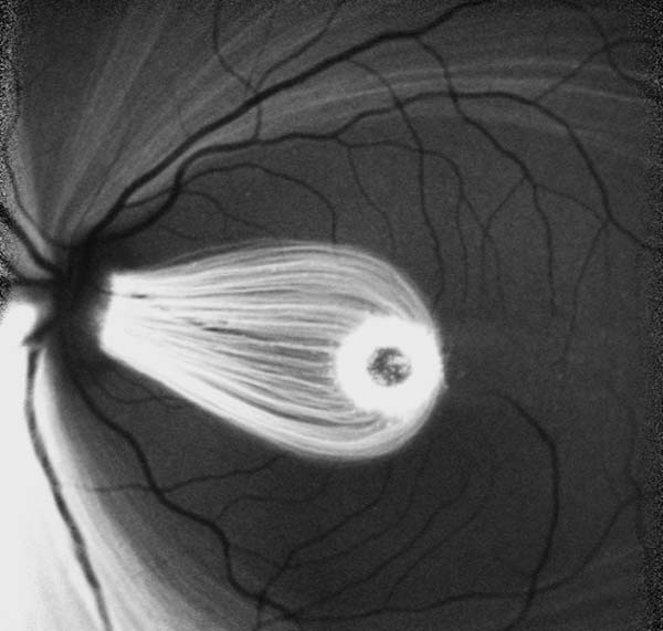 ophthalmic-imaging-2