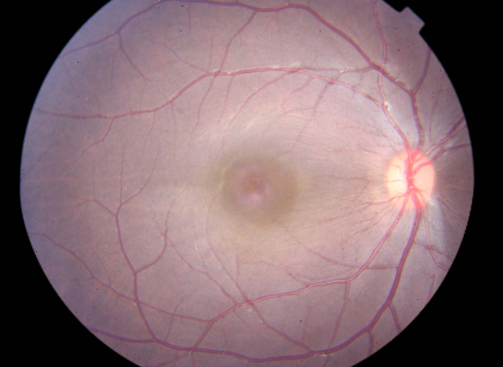 ophthalmic-imaging
