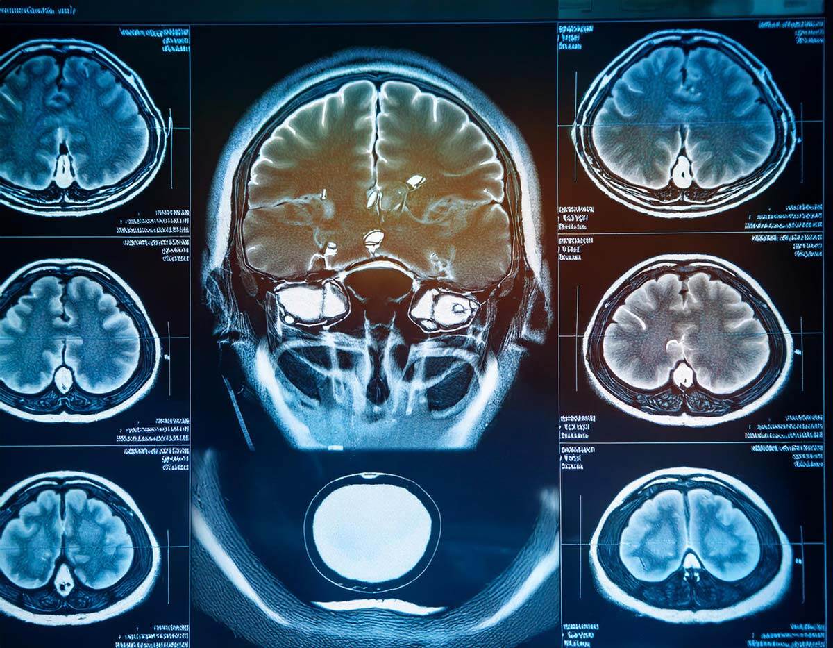 pet-scan-1