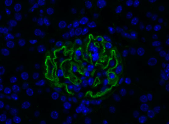 Gene Therapy Helix 1