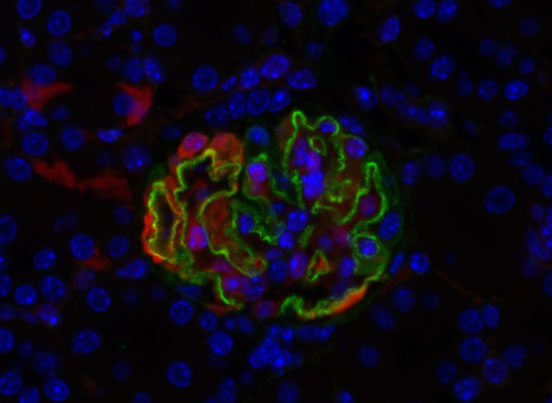 Gene Therapy Helix 2