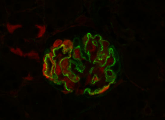 Gene Therapy Helix 3