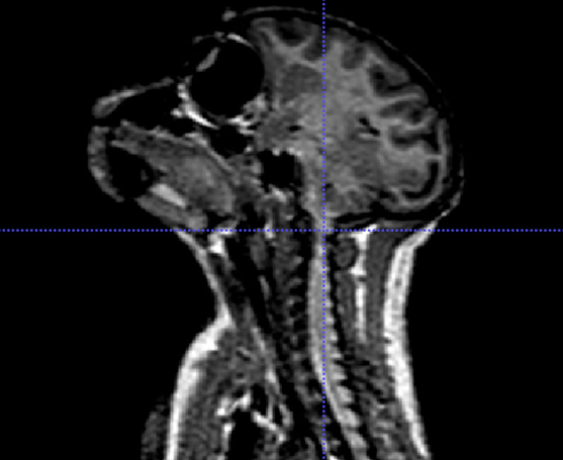 African Green Monkey MRI